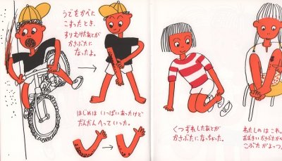 画像1: かさぶたくん【状態C】